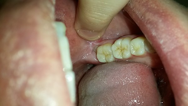 20190531_064445.jpg