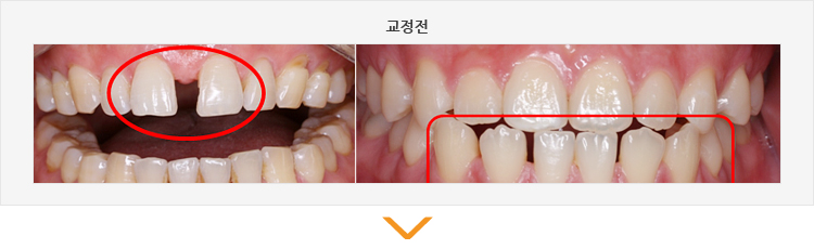 교정전